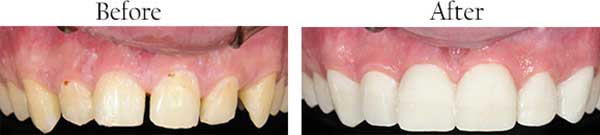 dental images in Irvington
