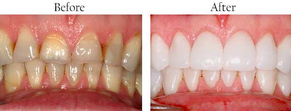 dental images 46219